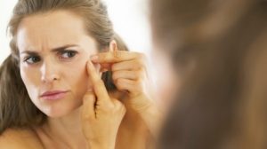 Kiat Mengatasi Jerawat Batu