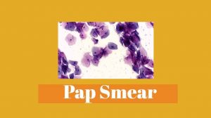 Pap Smear : Pengertian, Manfaat dan Langkah Pemeriksaan