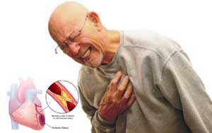 Tips mencegah serangan jantung
