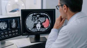 Ilustrasi pemeriksaan medis pada splenomegali atau pembesaran limpa