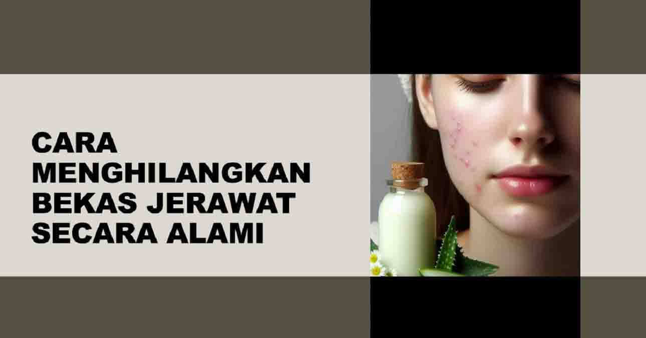 14 Cara Menghilangkan Bekas Jerawat Secara Alami Yang Efektif Dan Aman