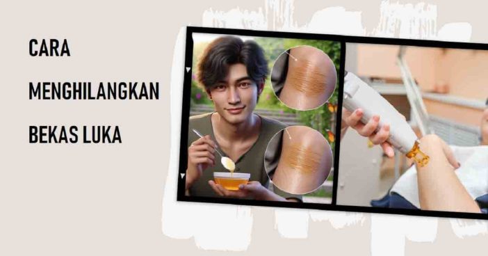 Cara Menghilangkan Bekas Luka