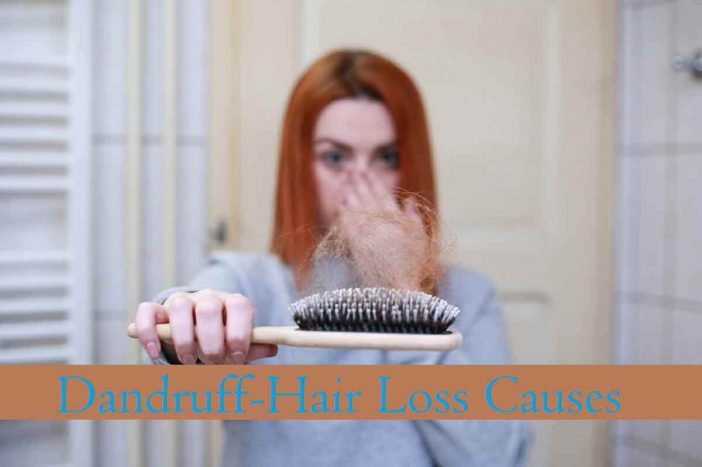 Causes of Dandruff and Hair Loss